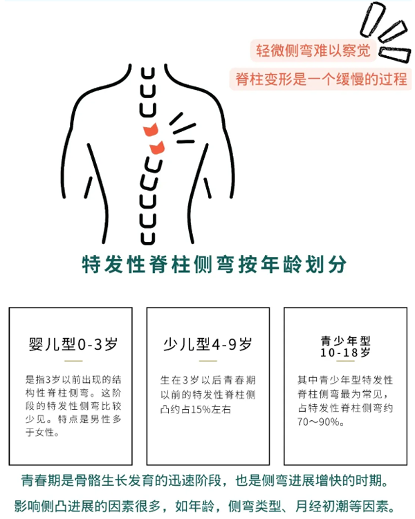 特发性脊柱侧弯按年领划分