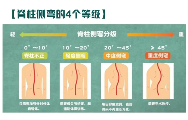 【坐姿一定要纠正‼️】孩子坐姿是关键，别再耽误孩子